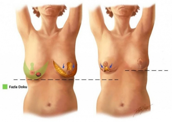 Вот критическая, негативная информационная статья на основе предоставленной информации: